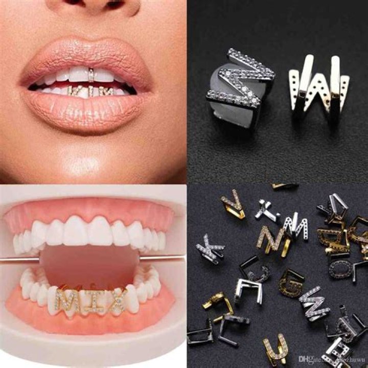 Are gold teeth unprofessional?