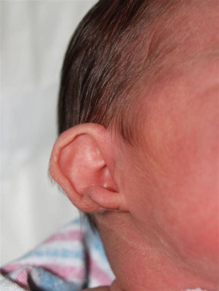 Can flying damage baby's ears?