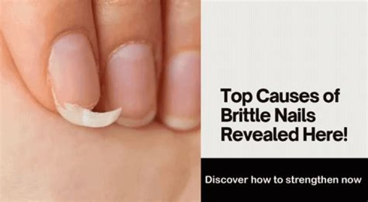 Does hemochromatosis cause brittle nails?