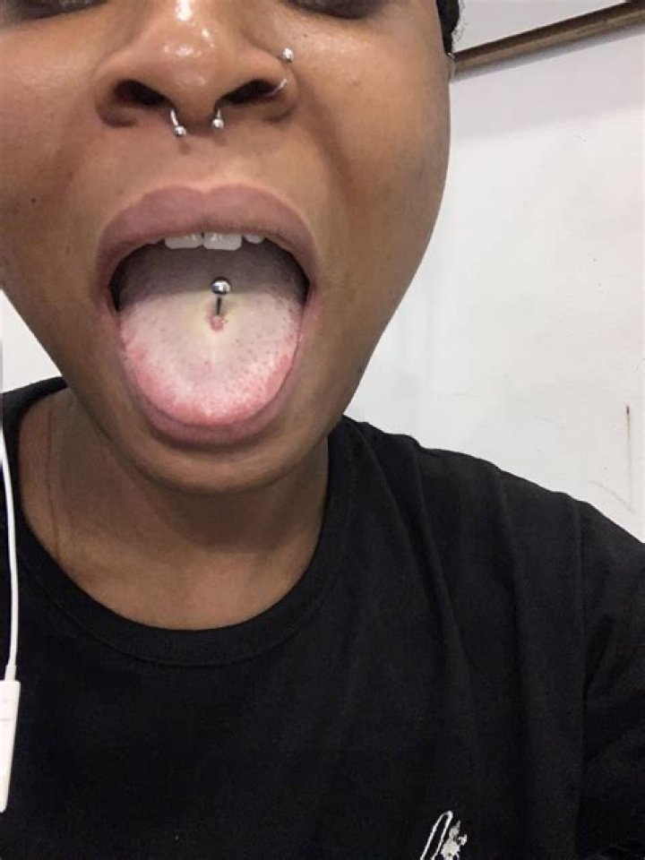 Does ice help tongue piercing?