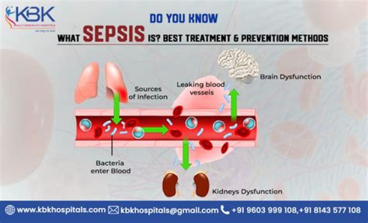 How do you reverse sepsis?
