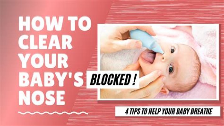 How do you unblock a baby's nose?