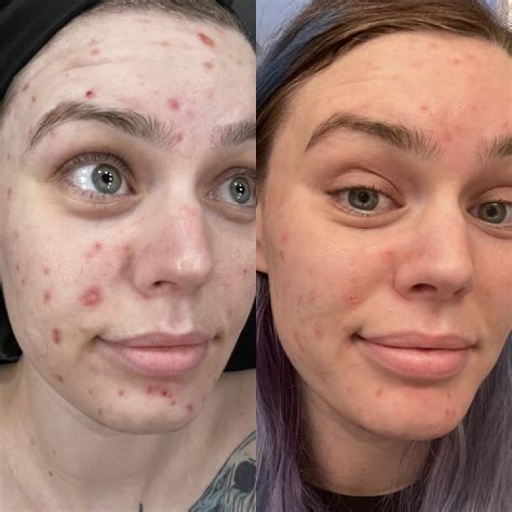 Is Triss supposed to have red hair?