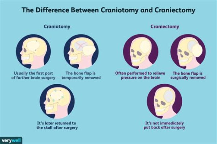 What are the complications of craniotomy?