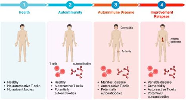 What autoimmune disease is associated with eczema?