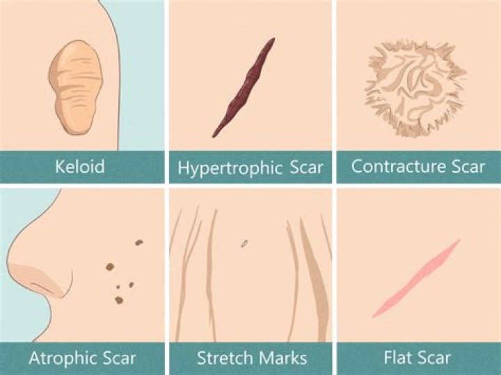 What does painful scar tissue feel like?
