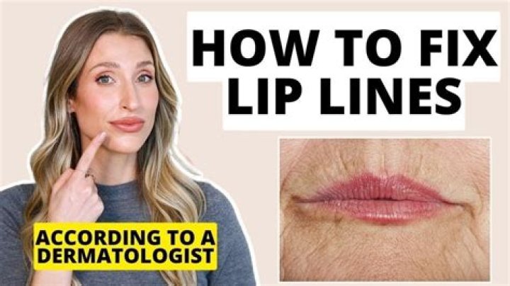 What is best for lip lines?