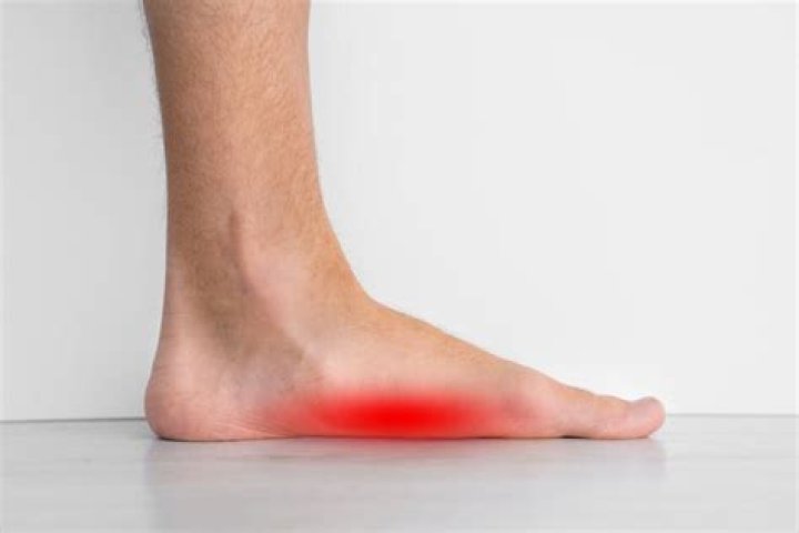 What issues can flat feet cause?
