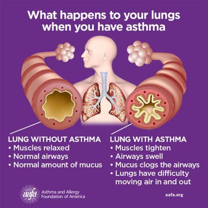 What kind of dog helps with asthma?