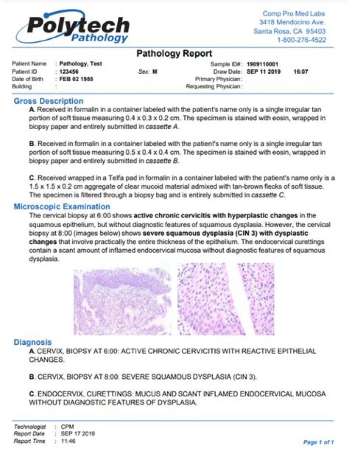 What will the pathology report reveal?