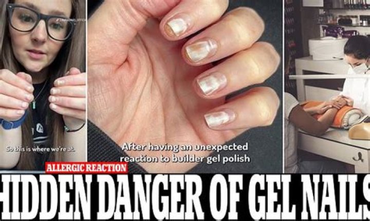 Why do my nails itch after getting them done?