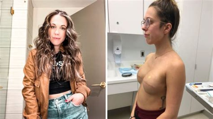 Why do people remove their boobs?