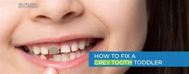 Why does a child's tooth turn grey?